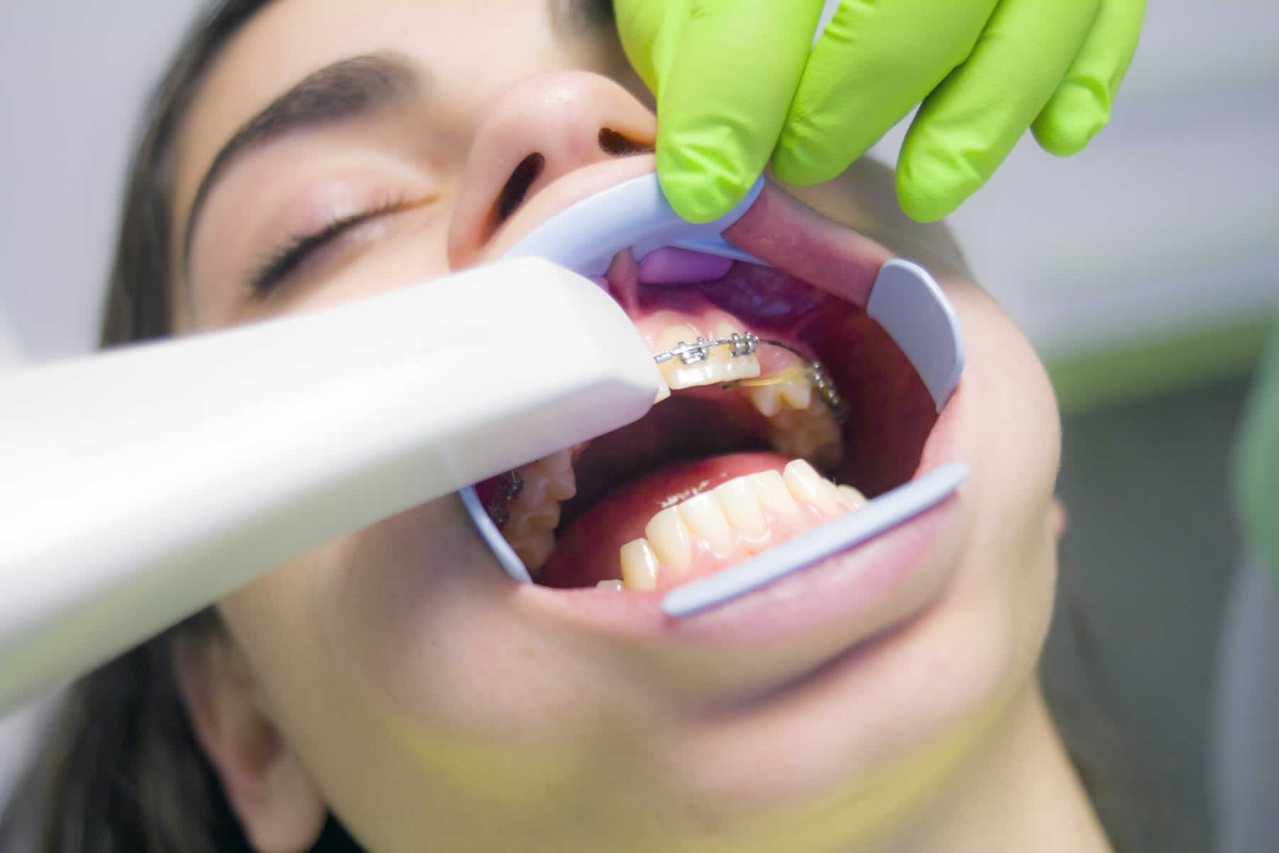 When Is The Correct Time To See An Orthodontist?