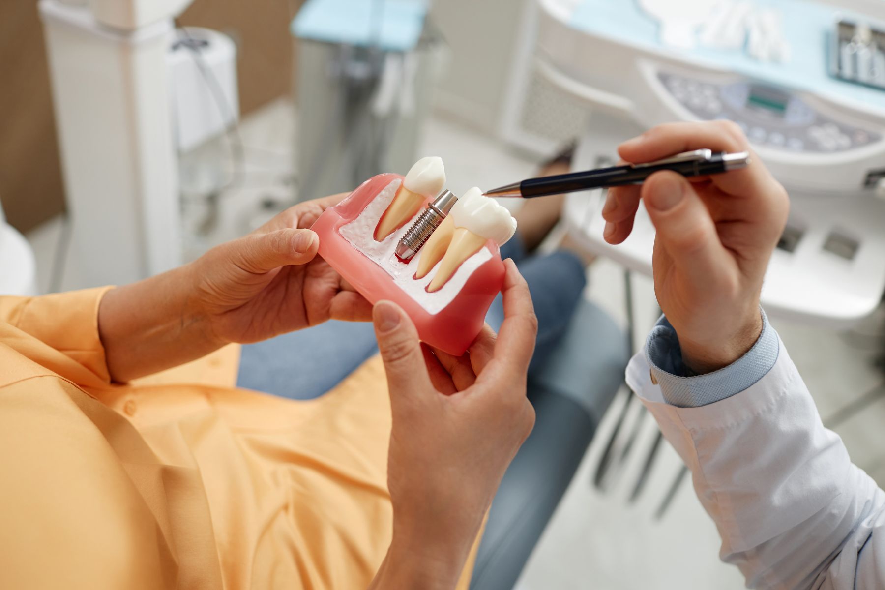Información esencial sobre los implantes dentales: 5 datos clave a tener en cuenta